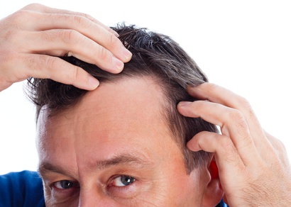 Was hilft gegen Haarausfall?